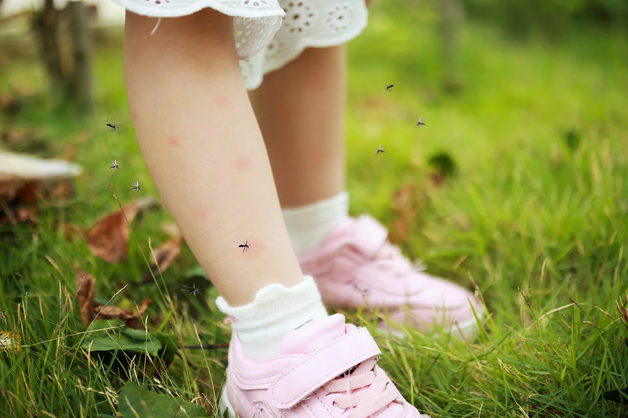 urocza dziewczynka ma wysypkę skórną i alergię na komary na nogach podczas zabawy na zielonej łące na świeżym powietrzu